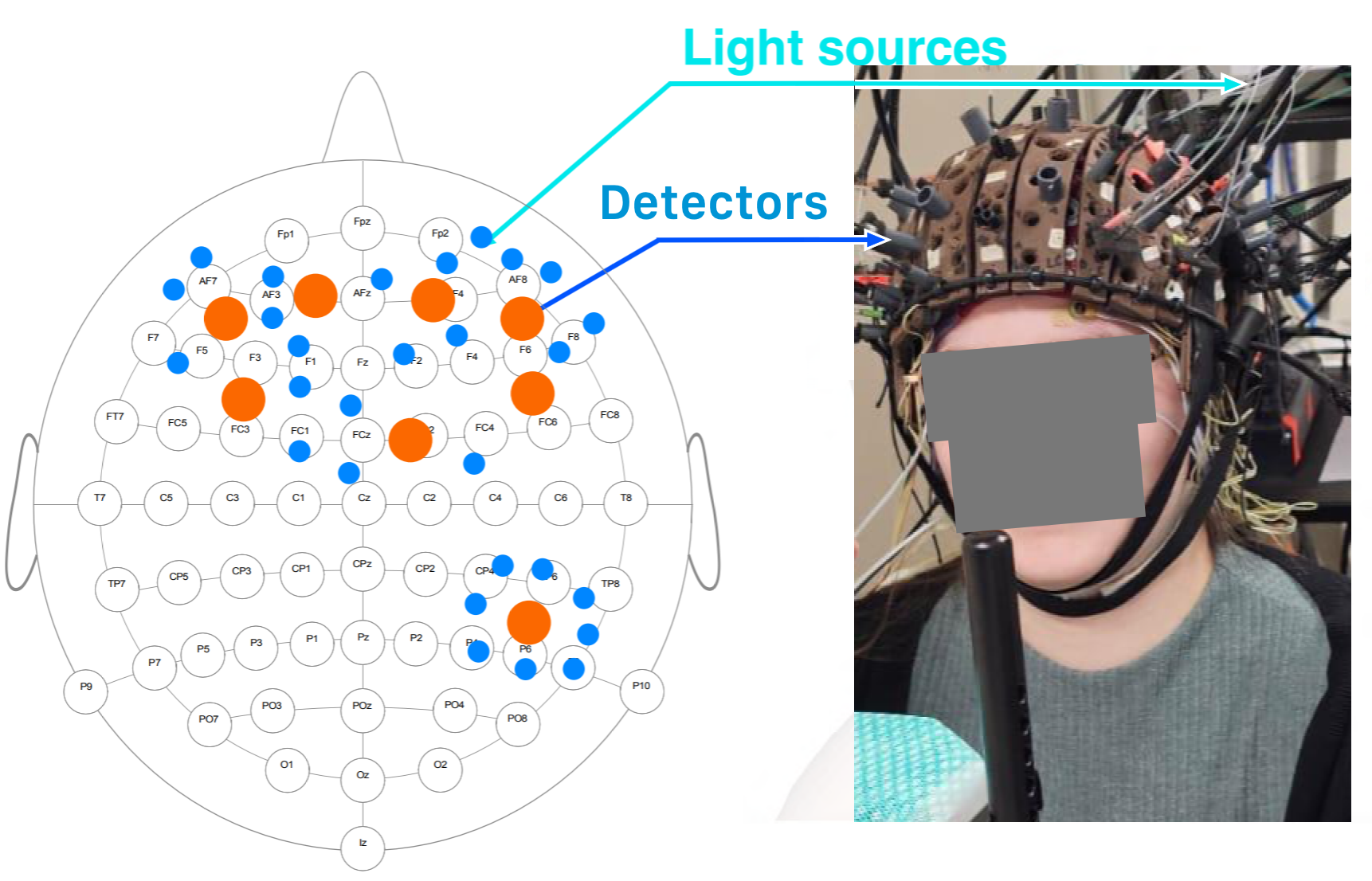 The EEG–FONI montage locates light sources, detectors, EEG electrodes and the custom-made experimental setup.